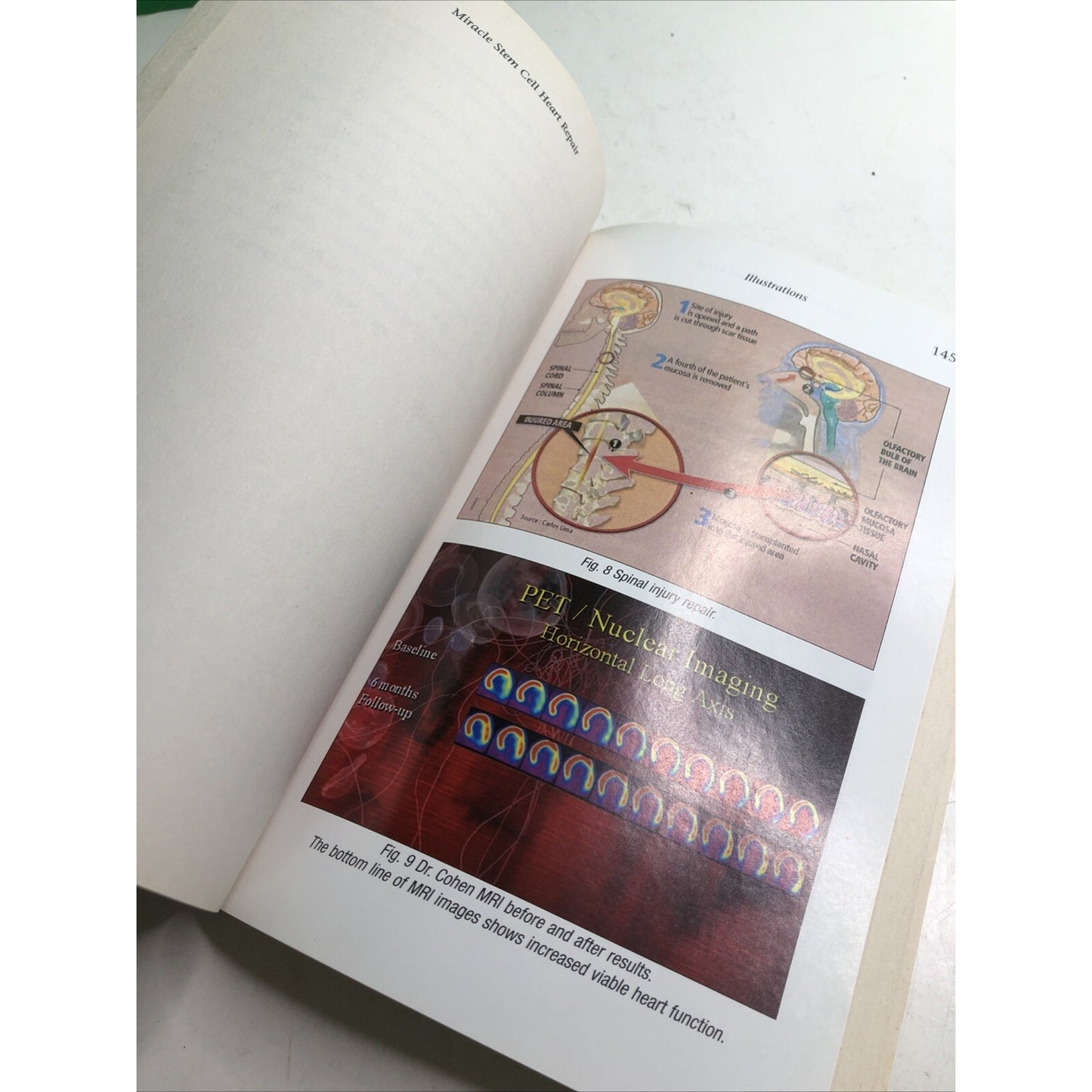 MIRACLE STEM CELL HEART REPAIR BY CHRISTIAN WILDE 2006 PB Medical Help Patients