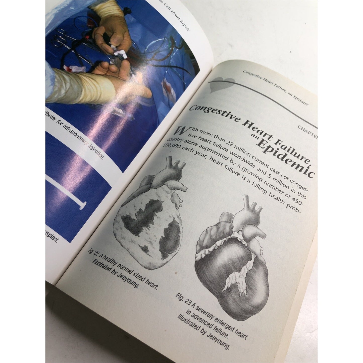 MIRACLE STEM CELL HEART REPAIR BY CHRISTIAN WILDE 2006 PB Medical Help Patients